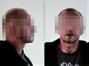 Zestawienie dwóch zdjęć twarzy mężczyzny od frontu i prawego profilu